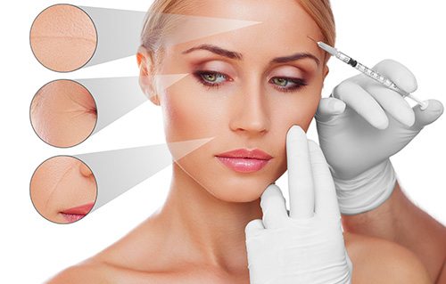 Botox e fillers dermatologiche