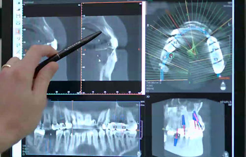 Come diagnostichiamo. Immagini panoramiche. 3D scanner