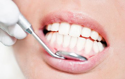 Periodontitis treatment