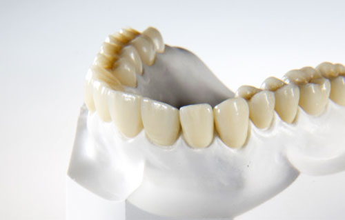 Zirkoninia crowns. Metal-ceramic crowns. Dental bridges
